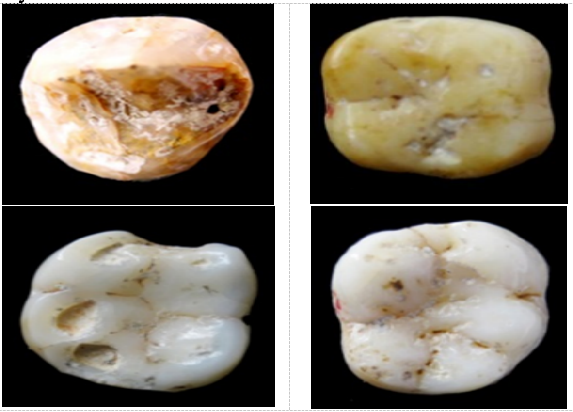 Hoá thạch Răng người Homo Erectus 475.000 năm tại Hang Thẩm Khuyên